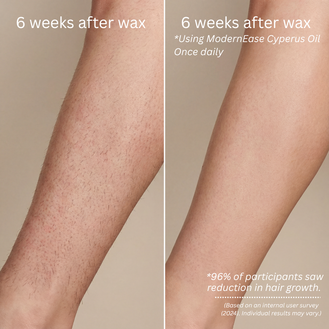 Valorie Cyperus Oil — Hair Reduction Treatment (60ml)